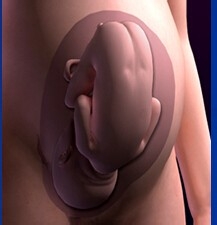 有关羊水的重要性的科普视频,辨别羊水最简单的方法