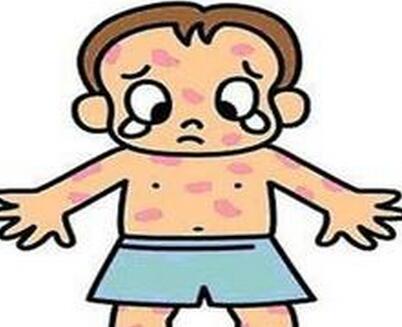 儿童水痘症状及治疗方法是什么,儿童水痘有什么症状