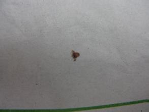 阴虱的传播途径,阴虱只有虫卵会传播吗