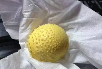 用煮熟的鸡蛋滚身上能解除湿气吗,用鸡蛋祛湿气需要剥壳吗