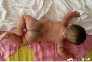 九个月宝宝手臂上起了个脓包,9个月宝宝手臂里面有个硬疙瘩