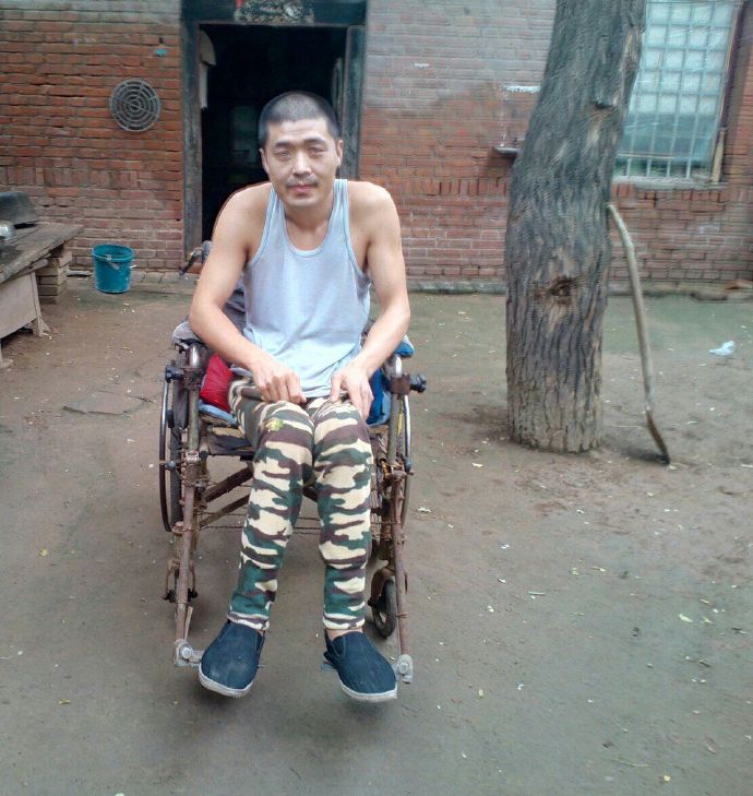 截瘫病人残余尿高出200怎么治,截瘫要怎么治疗最好