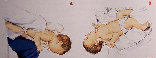 孩子误服异物怎么提示家长,婴儿误服药物异物怎么办