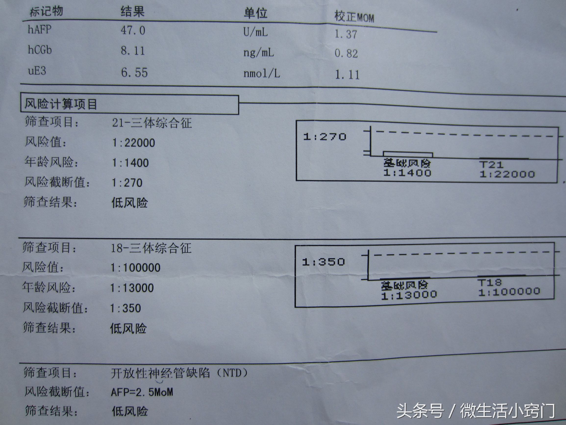 孕检时的各种问题,孕检三大注意事项