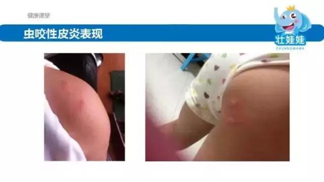 夏季常见的皮肤问题,夏季皮肤问题怎么处理