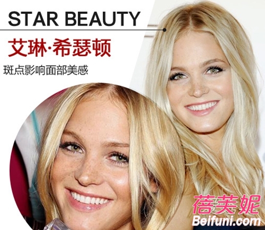 褐青色斑治疗好了还会再长吗,脸色暗黄黄褐斑怎么调理最有效