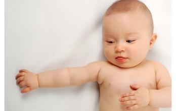 婴儿湿疹一直复发是什么病因,湿疹的病因及发病机制是什么