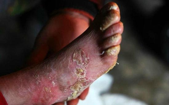 8岁男孩身患怪病,男孩患怪病的真实案例