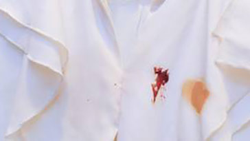 羽绒服油渍去除方法,处理油渍最好的方法