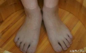 治感冒喉咙痛的偏方,治感冒喉咙疼的民间偏方小妙招