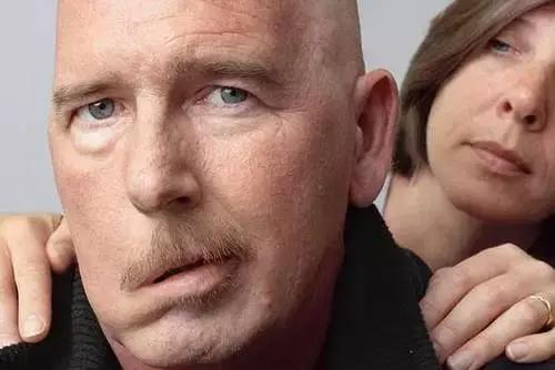 口眼歪斜护理要素！这四点你应该掌握