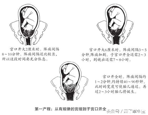 产妇急产危害,产妇分娩时会遇到哪些危险