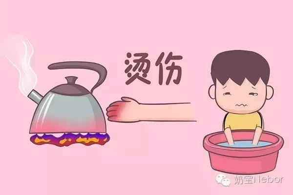 怎么判断宝宝烫伤是否严重,宝宝被烫伤的正确处理方法