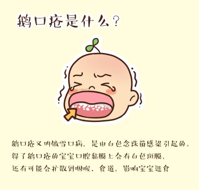 鹅口疮是什么颜色的,鹅口疮是什么颜色