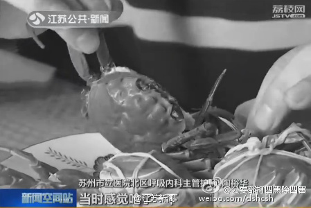 苏州老伯反复咳嗽竟因蟹壳卡喉6年！