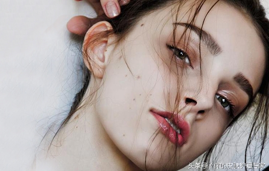 怎么去除斑点的小妙招视频,手部斑点怎么去除