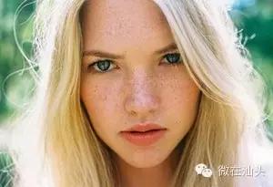 点痣会引发痣癌变吗,痣旁边长了小痣是不是癌变