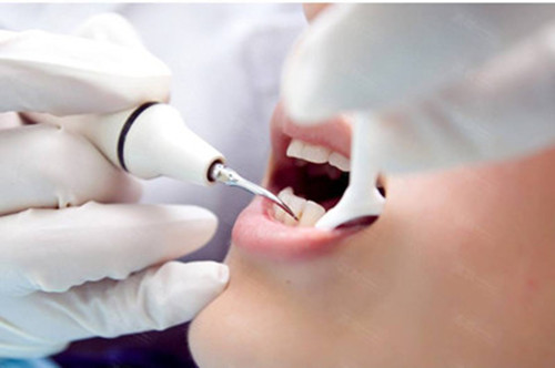 白酒治疗牙周炎的偏方怎么使用,牙周炎反复脓肿也不疼有什么偏方