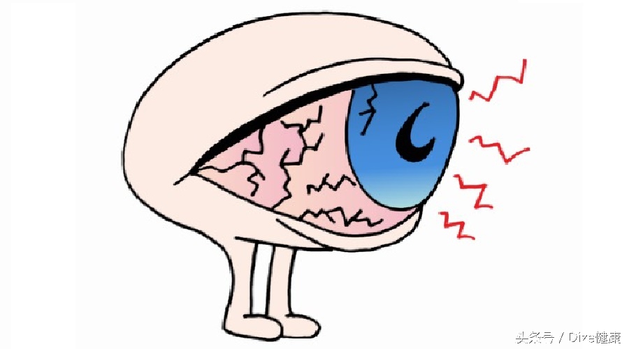 隐形眼镜戴久了干涩怎么解决,隐形眼镜戴久了干涩用什么药