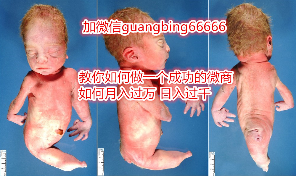 美人鱼生了个没有尾巴的宝宝,生宝宝的美人鱼娃娃