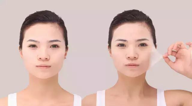 过期面膜用了过敏了怎么办,脸部过敏可以敷医用面膜吗