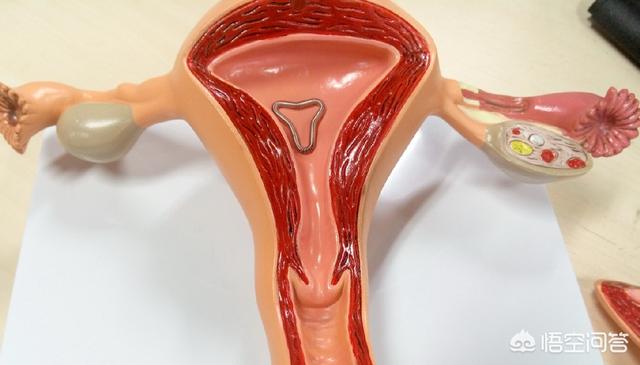 上环对女性有哪些不良现象,上环对女性有哪些危害和好处