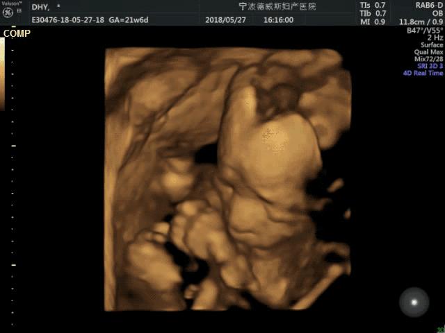 怀孕几个月做四维彩超比较合适,怀孕几个月能做四维图片