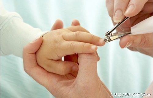 宝宝手指起皮长倒刺脸发黄,婴儿手指长倒刺撕下去红肿