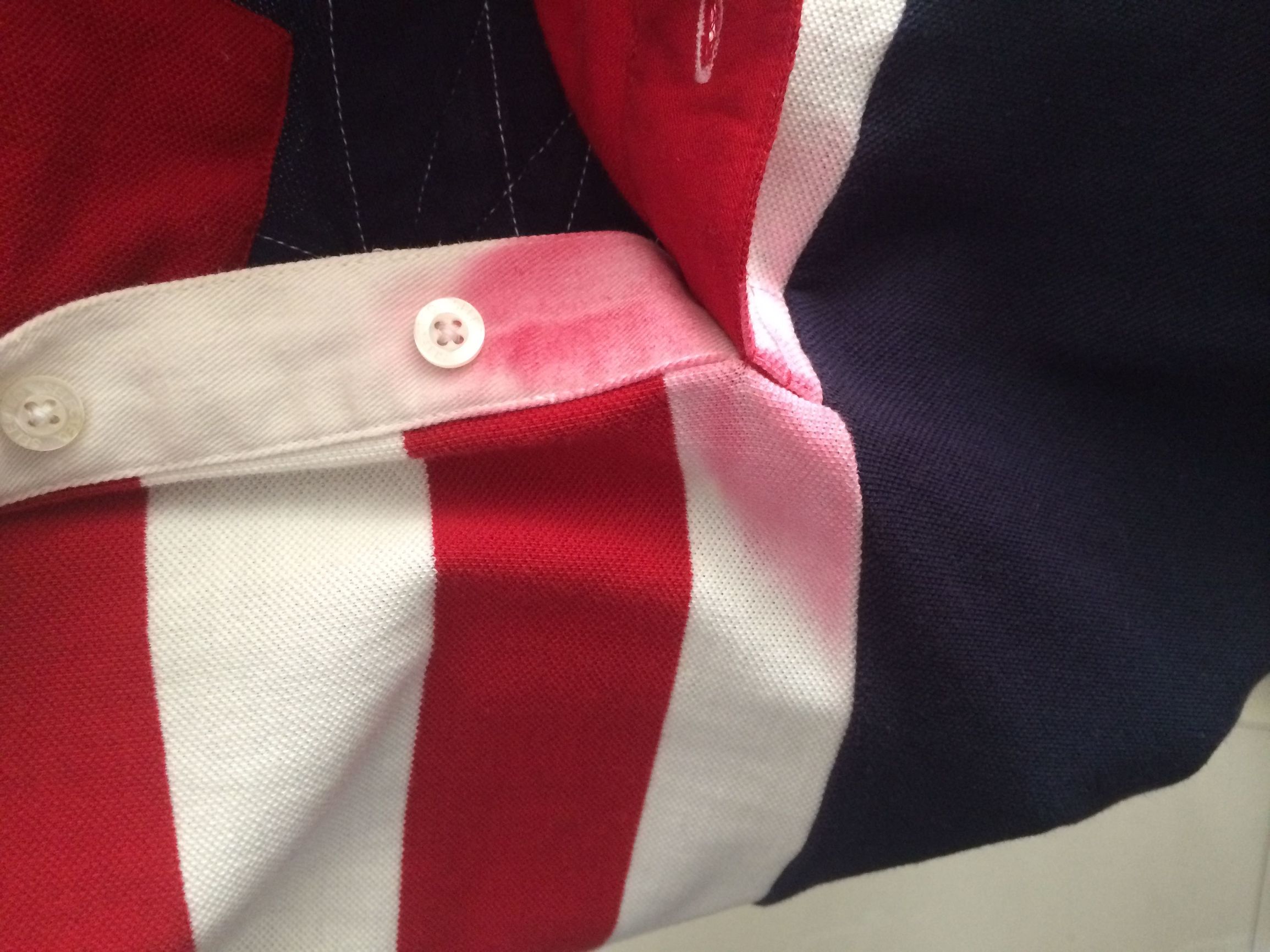 太阳晒褪色的衣服还原,绿色衣服晒褪色了怎么办