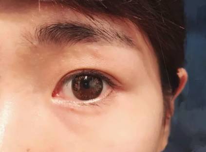 美瞳神器排行榜,美瞳神器单眼皮测评