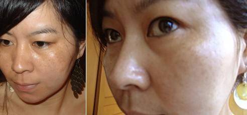 美白丸怎么用才是正确的,美白丸哪个牌子效果好知乎