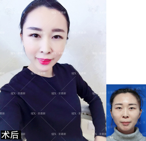 明明才20几岁看着显老,年纪不大看起来显老