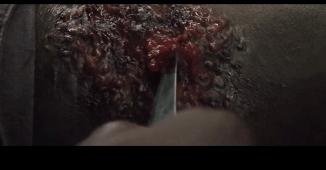 密集恐惧者请绕行,友情提示胆小的朋友请谨慎观看