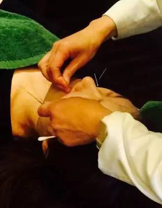 杭州看鼻炎的地方,杭州鼻炎在哪治