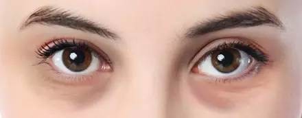 星星眼的小技巧,如何轻松get星星眼