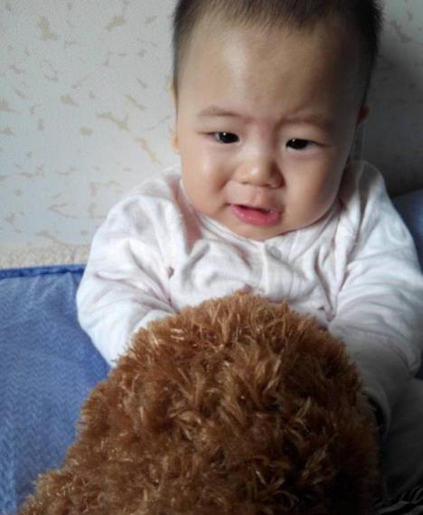 孕中晚期皮肤瘙痒不容小视！警惕妊娠肝内胆汁淤积