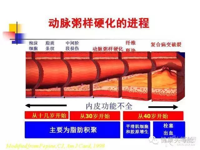 生鲜蔬果汁健康小百科之动脉硬化