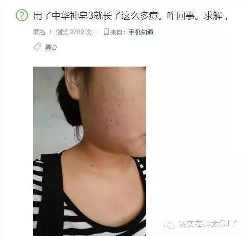 张庭现身微商宣传活动,张庭最新微商消息