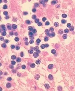 《釜山行》里的丧尸，现实中会出现吗？