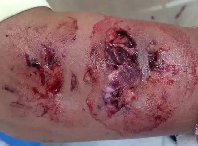 狗苗抓回来就要先打疫苗吗,买狗疫苗要打全才能买回去吗