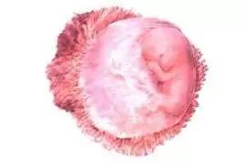 复发性流产的病因主要有,复发性流产根源