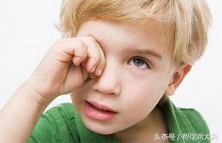 干眼症的人注意事项,七条措施预防干眼症