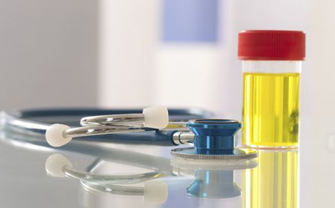 医生验尿结果大吃一惊,尿三杯试验的报告