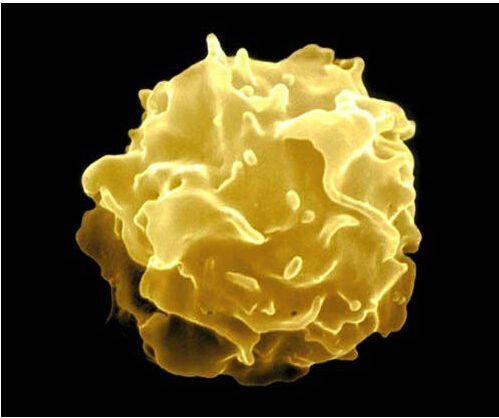 化疗白细胞低是什么原因造成的呢,化疗过程中白细胞过低是什么原因