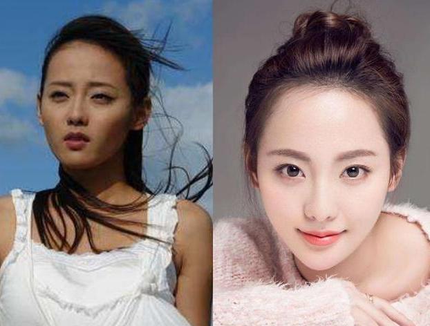 美白针副作用曝光,美白针是违规药品吗