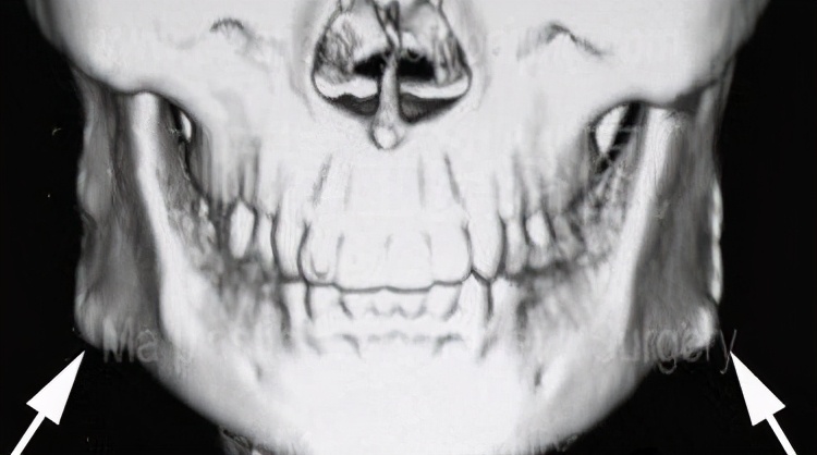 怎么样的方脸好看,怎样的方脸比较好看