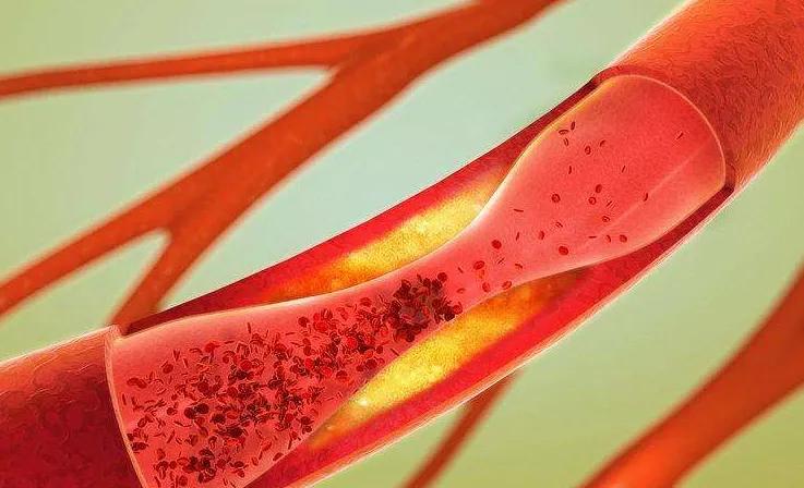 经常手麻脚麻是什么原因和征兆,解决经常手麻脚麻的最好方法