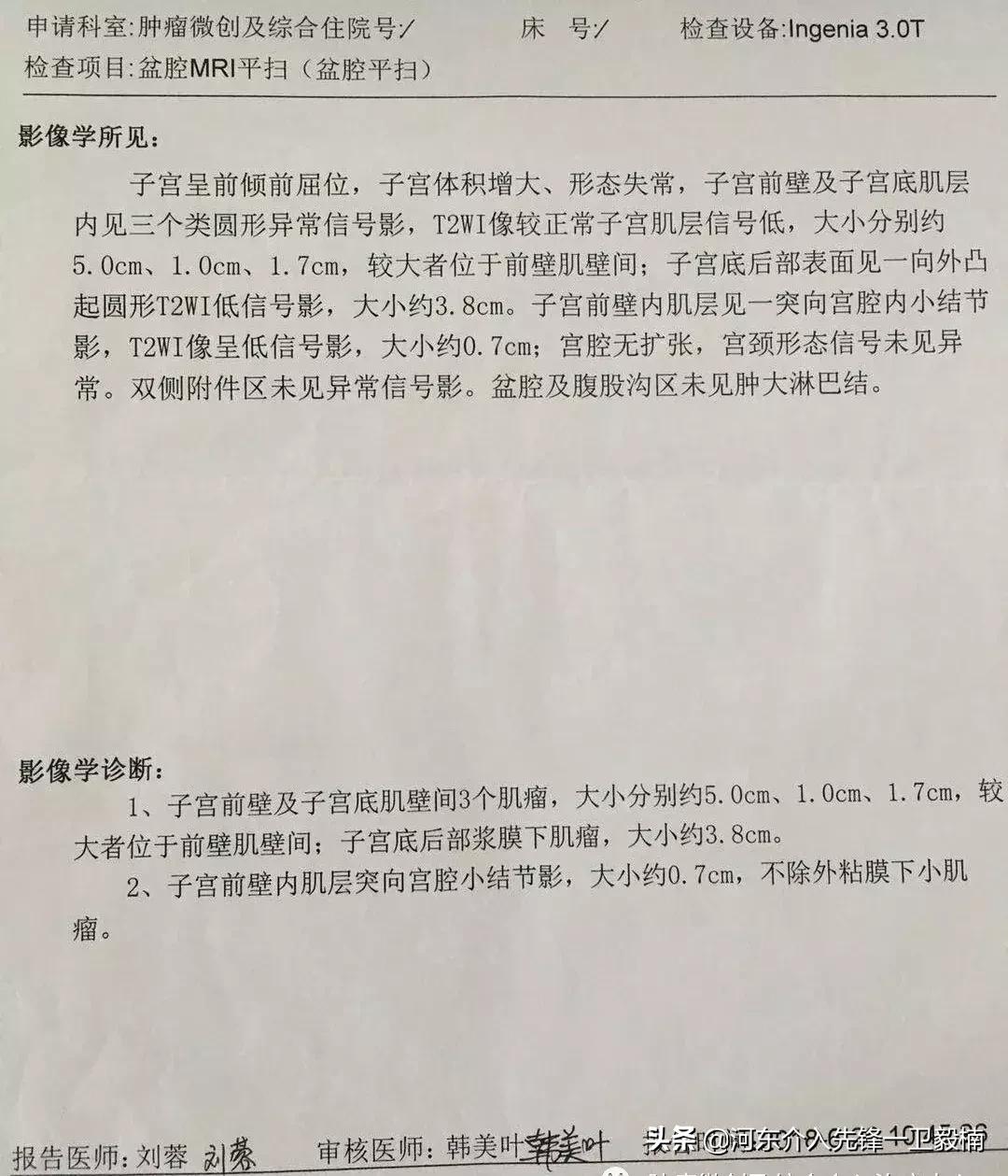 运城市第一医院肿瘤介入科,子宫肌瘤微创手术是超声介入吗