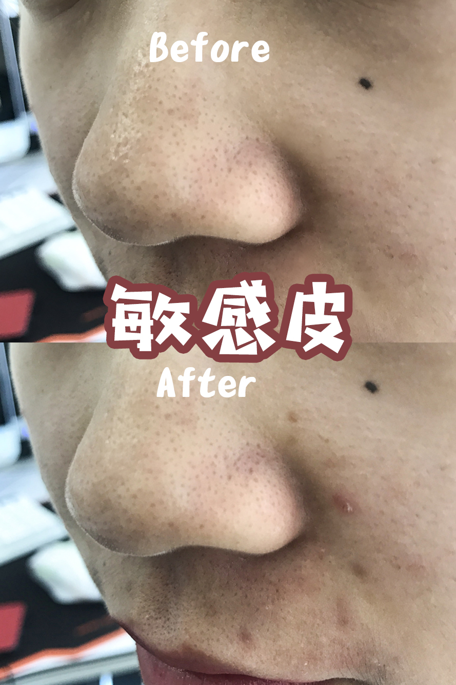 网红泥膜去黑头产品测评,去黑头泥膜是真的吗