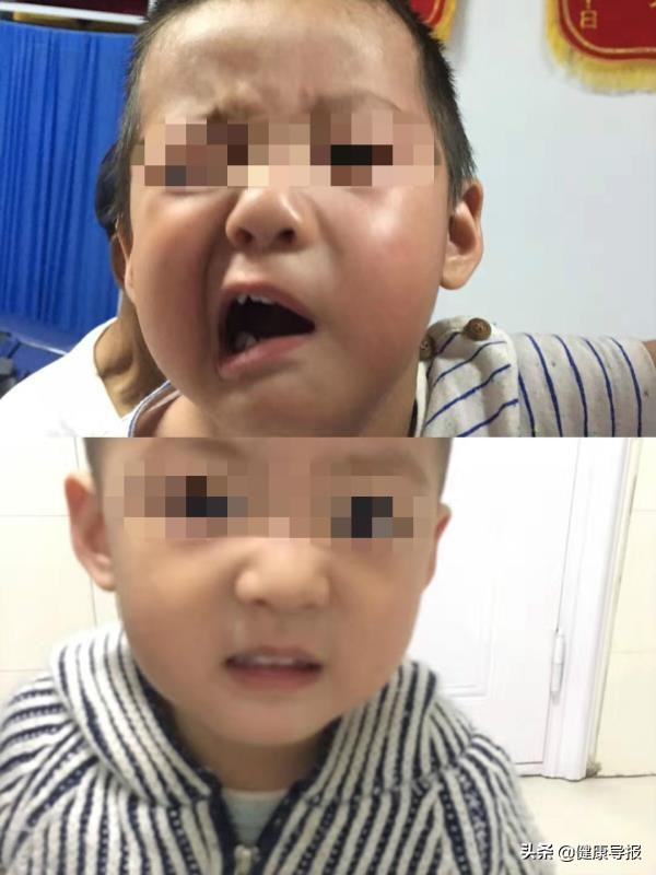 榆林三院康复科,榆林三院康复科理疗科